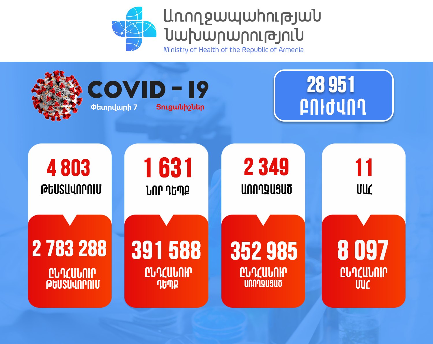 Հայաստանում արձանագրվել է կորոնավիրուսի 1631 նոր դեպք, 11 մահ