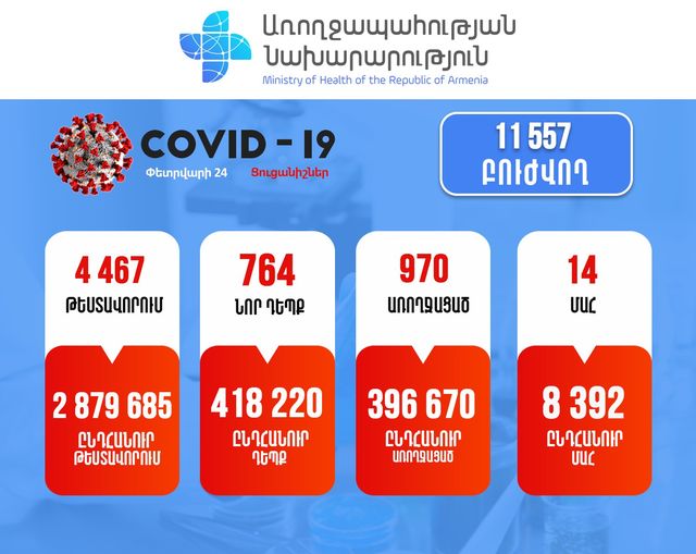 Հայաստանում արձանագրվել է կորոնավիրուսի 764 նոր դեպք, 14 մահ