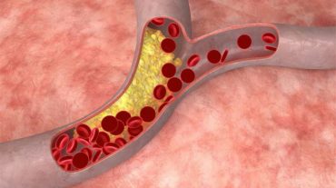 Խոլեստերինի մասին առասպելները հերքված են